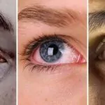 Vì sao mắt không sợ lạnh?